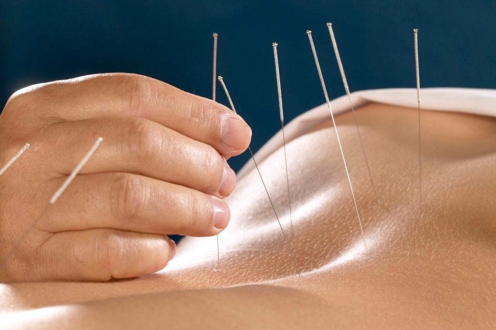 acupuncture pour soigner le psoriasis
